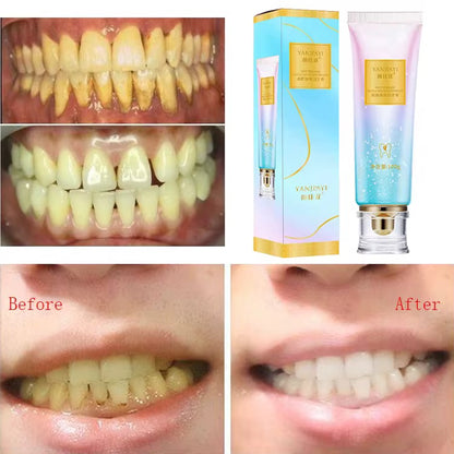 ✨ NICACINAMIDE – Dentifrice Blanchissant ✨