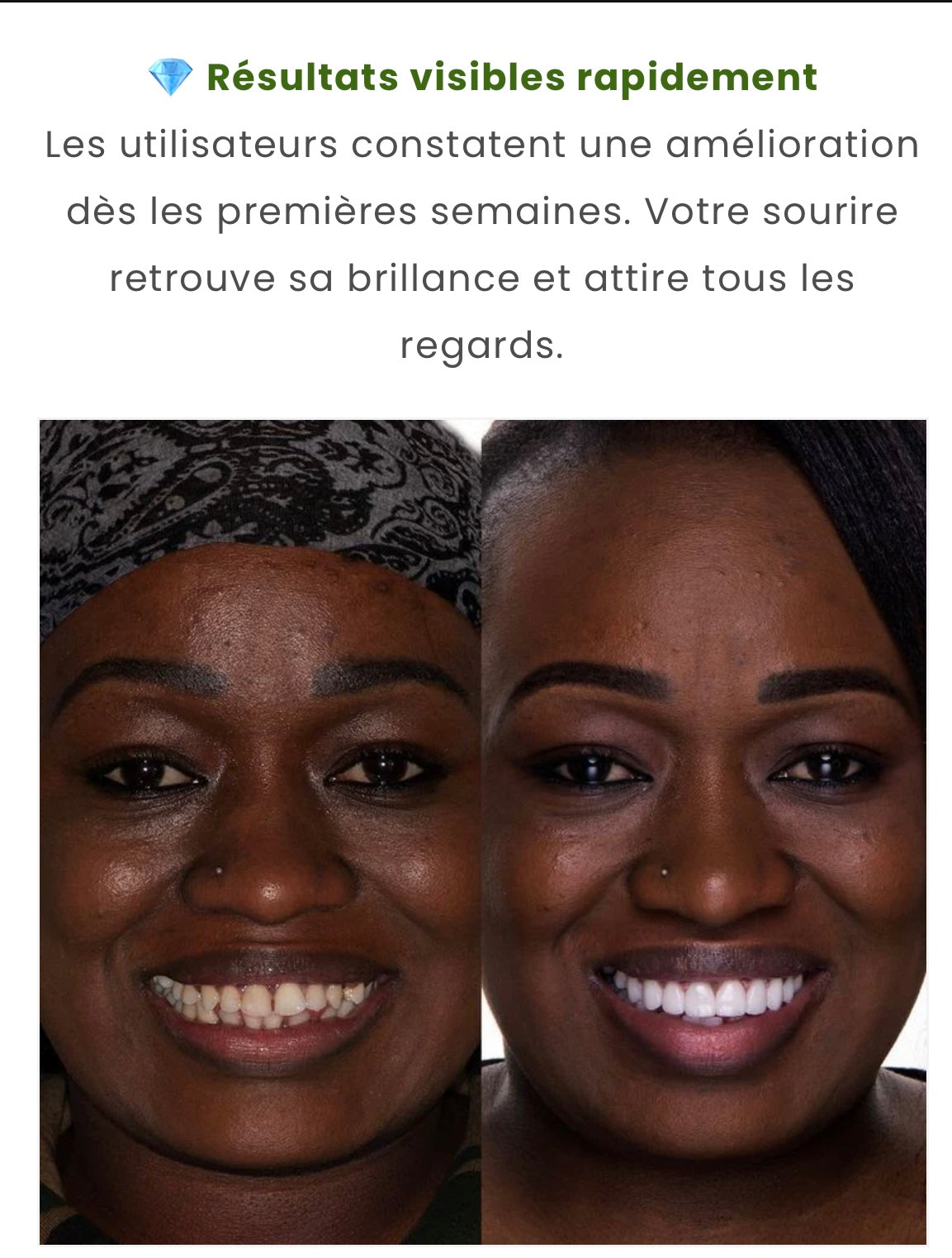 ✨ NICACINAMIDE – Dentifrice Blanchissant ✨