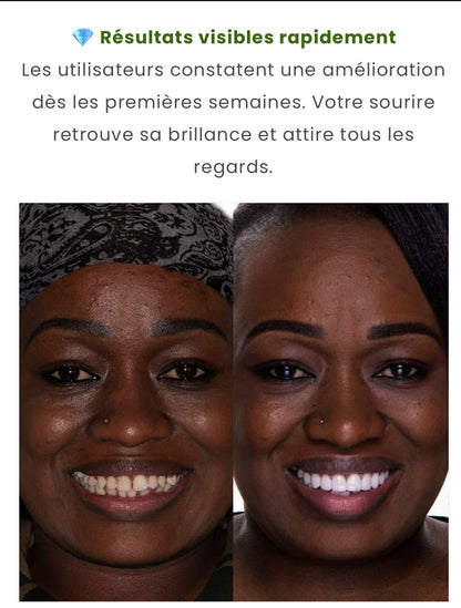 ✨ NICACINAMIDE – Dentifrice Blanchissant ✨